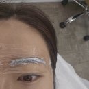뷰티위크(스마일라식 후기+눈썹문신)