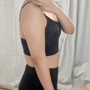 편한마디통증클리닉 | 천호 팔뚝무한람스 당일 후기 | 앞볼록·뒷볼록 시술부터 통증, 붓기, 다음날 경과까지