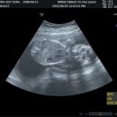 대광교회 | [임신 기록] 19-20주) 첫 태동!/임산부 미용실/하이베베/20주 정기 검진/광양시 보건소 임신 축하...