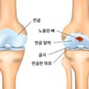 손바닥 통증 증상별 원인 및 치료 이미지