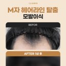 글로웰의원 이미지