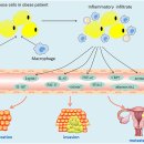 비만(metabolic syndrome)과 자궁내막암의 관계!! 2019 이미지