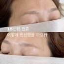 글라스미 배곧신도시점 | 시흥·송산에서 차로 15분, 굳이 안산까지 눈썹문신 찾아오는 진짜 이유 (탈각후기 증명)