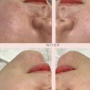 퀸에스테틱 이미지