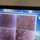 덕영빌딩 | 중구] 동성로 문화동 〔 B10 에스테틱 본점 〕에서 모공 완전 청소하고 투명 광채 물광 피부 얻은 후기