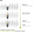 유노치과 네이버블로그