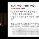 부정맥(Cardiac arrhythmias) 이미지