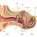 드림보청기 이미지