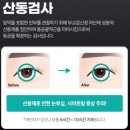 제신약국 | 부산 서면 스마일라식 내돈내산 후기