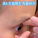 돼지탈출넘버원 | 안경탈출은 기뻤으나 드림렌즈의 길은 멀고도 험한..