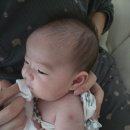 안소아과 | (정보) 판교 1차 영유아검진/피내용 BCG 접종 소아과 정보 및 후기