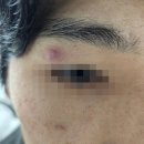 (유)에메트 네이버블로그