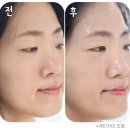 이든코스메틱 | 홈쇼핑 연말선물 최화정쇼 추천 PDRN 리들샷 300 리뷰