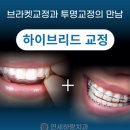 연세하랑치과의원 네이버블로그