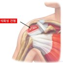 정승기정형외과의원 네이버블로그