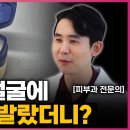 아무도 알려주지 않는 바세린 올바른 사용법 이미지