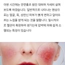 10월20일★운동공간★안면 홍조 원인 및 없애는법!확인하고 출석해 보아요~^^ 이미지