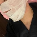 기가빌딩 | 서초구 강남대로 435 주류성빌딩 8층에서 볼뉴머(리프팅) 후기