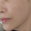 미작뷰티 천안 아산 기미주근깨잡티제거 피부관리샵 케어 후기