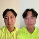 [다니에르 리뷰] 강남피부관리 아이스타뷰티라운지 청담피부관리 후기