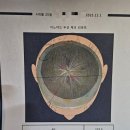 (주)이노야드 | 👶 5개월 여아 단두 고민 + 수원 이노야드(두상교정) 방문기