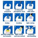 필치과병원 | 춘천치과추천? 대학병원에서 소개하는 곳의 비밀 1가지