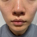 양산 / 스킨스토리 양산플라즈마 양산슈퍼젝션 양산피부관리샵