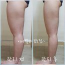 더벤티 광주금호점 | 놀라워 광주금호동에서 이런 꼼꼼 시술 본 적 있나요 이너벨라 광주금호점 솔직 후기
