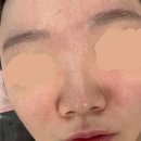 천안 신부동 피부관리 추천 샵토탈뷰티살롱에서 트러블 블랙헤드 관리받은 후기