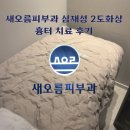 새오름피부과의원 | 새오름피부과 심재성 2도화상 흉터 치료 후기 (레이져3회 후)