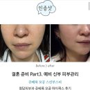 쥬베룩 모공 스킨부스터 후기 하이쿡스로 화장 잘 먹는 예비신부 쫀쫀 피부관리
