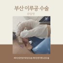부산 선천성이루공 수술하고 온 후기