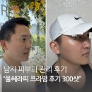 프라임 | 울쎄라피 프라임 후기 남자 피부과 관리 효과 비용 공유