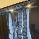 하나한방병원 | 허리디스크 급성기 한방병원 입원 후기