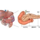 췌장암 초기 원인 황달 가족력 브라카유전자 이미지