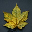 라인아트의원 | 모발이식 받은 단풍나무 🍁. 세계최초. 여성 연예인 모발이식 헤어라인