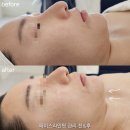 페이스온리 | 덕계윤곽관리 전문 | 덕계에스테틱 '스킨온리'에서 페이스라인핏케어 받은 후기