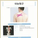 Rhomboid major 이미지