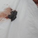 고흥윤호21병원 | [5년 전 오늘] 안전불감증 고흥 윤호21병원 부상자의 절규
