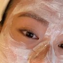 뷔에고 | 김포 운양동 피부관리 뷔에고에스테틱 | 옆광대 경락 후기