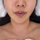 [대구 중구] 대구 중구 웨딩관리 : 로아에스테틱 | 피부 관리 찐 후기