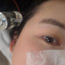 리얼후기연구소 | 덕풍동 모공관리 결담은피부연구소 다녀온 리얼 후기