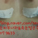 고운피부나라