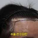 모엠의원 이미지