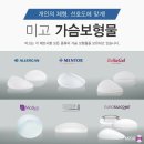 미고성형외과 | 가슴성형 유명한 병원 미고성형외과 가슴성형후기!