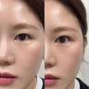 언더스타서울 | 속눈썹 펌과 언더 연장 처음 해봤는데 만족도 최고였던 별내 속눈썹 펌 뷰티크원 후기
