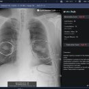 코끼리이비인후과의원 이미지