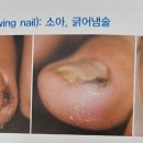 레푸스이천