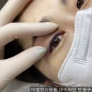 미밸런스의원 | 삼송역반영구추천 미밸런스의원 반영구 시술의 모든 후기