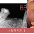 연세바른치과 이미지